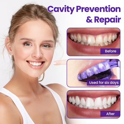 Biancat® OralMatrix Teeth Regeneration Mineral Powder🌟
