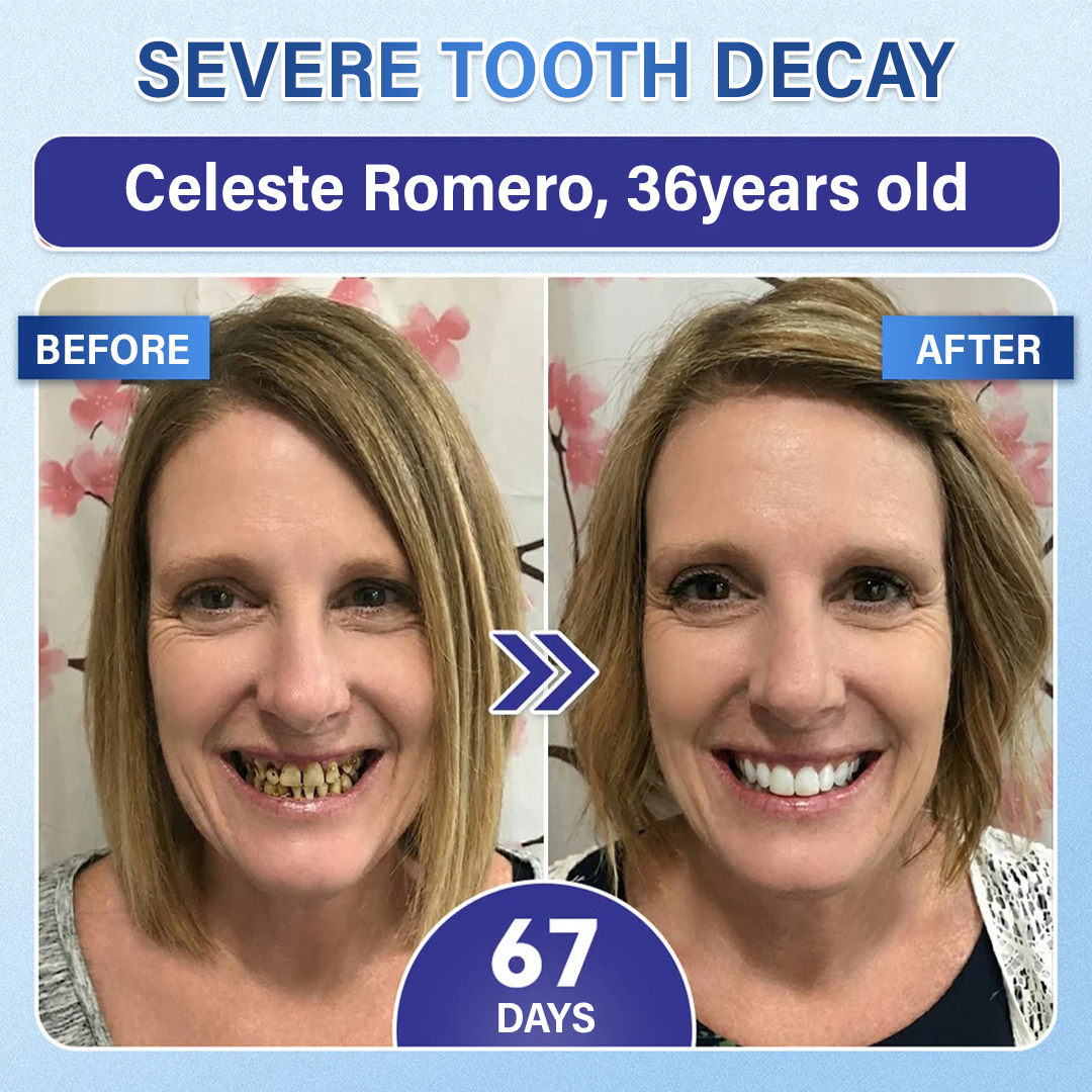 (NEW)Ceoerty® Tooth & Gum Repair Fast-Dissolving Microneedle Patch✨ (𝟓-𝐢𝐧-𝟏 💎 𝐑𝐞𝐛𝐮𝐢𝐥𝐝 𝐄𝐧𝐚𝐦𝐞𝐥 & 𝐃𝐞𝐧𝐭𝐢𝐧 • 𝐒𝐭𝐫𝐞𝐧𝐠𝐭𝐡𝐞𝐧 𝐆𝐮𝐦𝐬 • 𝐄𝐫𝐚𝐝𝐢𝐜𝐚𝐭𝐞 𝐓𝐚𝐫𝐭𝐚𝐫 & 𝐎𝐝𝐨𝐫 • 𝐖𝐡𝐢𝐭𝐞𝐧𝐢𝐧𝐠 • 𝐒𝐭𝐨𝐩 𝐓𝐨𝐨𝐭𝐡 𝐒𝐞𝐧𝐬𝐢𝐭𝐢𝐯𝐢𝐭𝐲)
