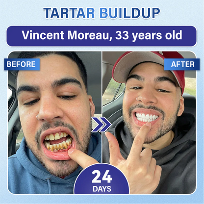(NEW)Ceoerty® Tooth & Gum Repair Fast-Dissolving Microneedle Patch✨ (𝟓-𝐢𝐧-𝟏 💎 𝐑𝐞𝐛𝐮𝐢𝐥𝐝 𝐄𝐧𝐚𝐦𝐞𝐥 & 𝐃𝐞𝐧𝐭𝐢𝐧 • 𝐒𝐭𝐫𝐞𝐧𝐠𝐭𝐡𝐞𝐧 𝐆𝐮𝐦𝐬 • 𝐄𝐫𝐚𝐝𝐢𝐜𝐚𝐭𝐞 𝐓𝐚𝐫𝐭𝐚𝐫 & 𝐎𝐝𝐨𝐫 • 𝐖𝐡𝐢𝐭𝐞𝐧𝐢𝐧𝐠 • 𝐒𝐭𝐨𝐩 𝐓𝐨𝐨𝐭𝐡 𝐒𝐞𝐧𝐬𝐢𝐭𝐢𝐯𝐢𝐭𝐲)