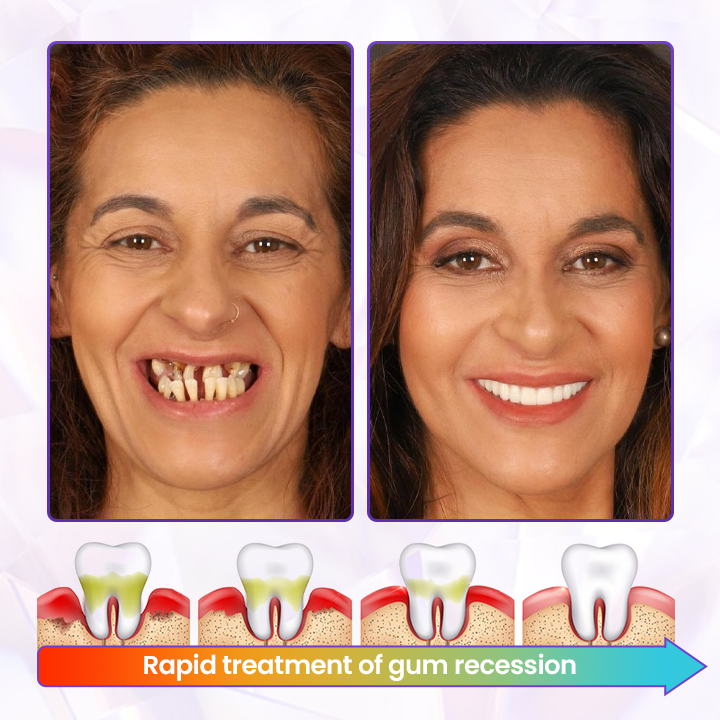 Biancat® BeeRenew Advanced Gum Healing Toothpaste🌟