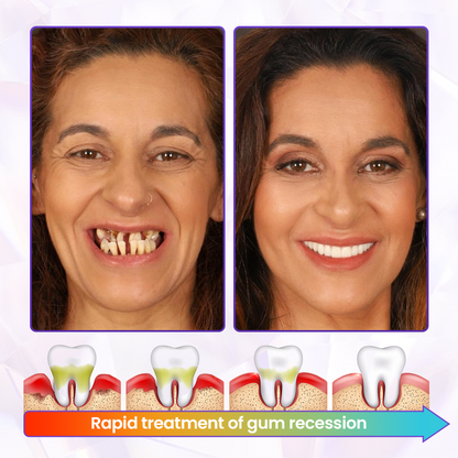 Biancat® BeeRenew Advanced Gum Healing Toothpaste🌟