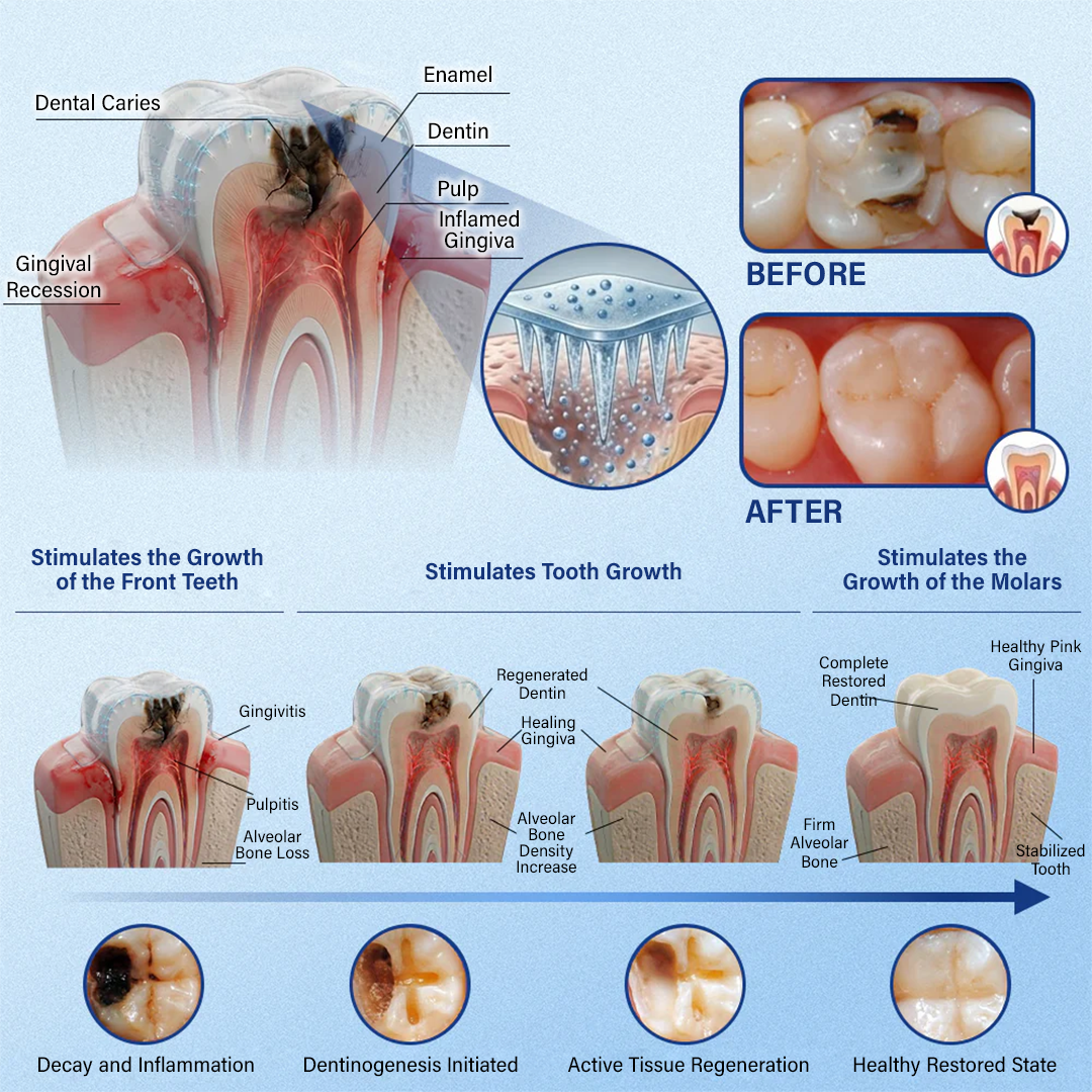 (NEW)Ceoerty® Tooth & Gum Repair Fast-Dissolving Microneedle Patch✨ (𝟓-𝐢𝐧-𝟏 💎 𝐑𝐞𝐛𝐮𝐢𝐥𝐝 𝐄𝐧𝐚𝐦𝐞𝐥 & 𝐃𝐞𝐧𝐭𝐢𝐧 • 𝐒𝐭𝐫𝐞𝐧𝐠𝐭𝐡𝐞𝐧 𝐆𝐮𝐦𝐬 • 𝐄𝐫𝐚𝐝𝐢𝐜𝐚𝐭𝐞 𝐓𝐚𝐫𝐭𝐚𝐫 & 𝐎𝐝𝐨𝐫 • 𝐖𝐡𝐢𝐭𝐞𝐧𝐢𝐧𝐠 • 𝐒𝐭𝐨𝐩 𝐓𝐨𝐨𝐭𝐡 𝐒𝐞𝐧𝐬𝐢𝐭𝐢𝐯𝐢𝐭𝐲)