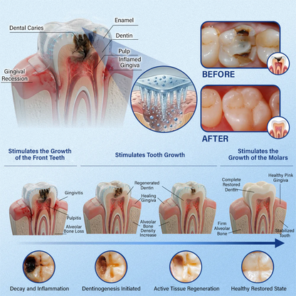 (NEW)Ceoerty® Tooth & Gum Repair Fast-Dissolving Microneedle Patch✨ (𝟓-𝐢𝐧-𝟏 💎 𝐑𝐞𝐛𝐮𝐢𝐥𝐝 𝐄𝐧𝐚𝐦𝐞𝐥 & 𝐃𝐞𝐧𝐭𝐢𝐧 • 𝐒𝐭𝐫𝐞𝐧𝐠𝐭𝐡𝐞𝐧 𝐆𝐮𝐦𝐬 • 𝐄𝐫𝐚𝐝𝐢𝐜𝐚𝐭𝐞 𝐓𝐚𝐫𝐭𝐚𝐫 & 𝐎𝐝𝐨𝐫 • 𝐖𝐡𝐢𝐭𝐞𝐧𝐢𝐧𝐠 • 𝐒𝐭𝐨𝐩 𝐓𝐨𝐨𝐭𝐡 𝐒𝐞𝐧𝐬𝐢𝐭𝐢𝐯𝐢𝐭𝐲)